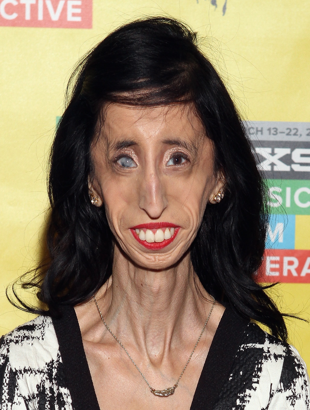 Lizzie Velasquez: The ugliest woman in the world image