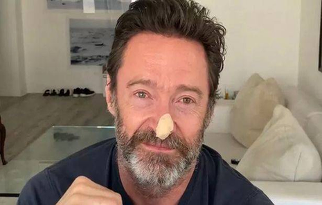 "Wolverine" actor Hugh Jackman opens up on the latest cancer scare image